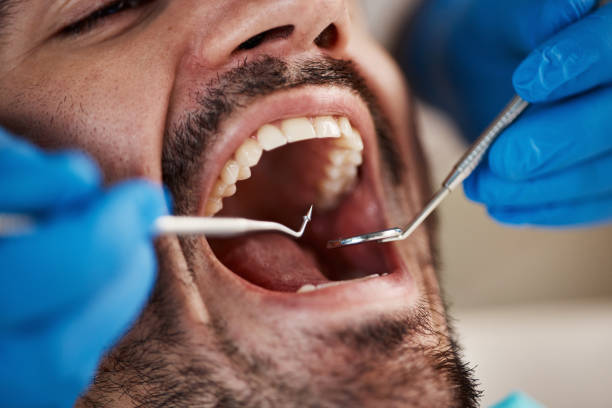 Best Broken or Cracked Tooth Emergency Dentist in Williston Highlands, FL